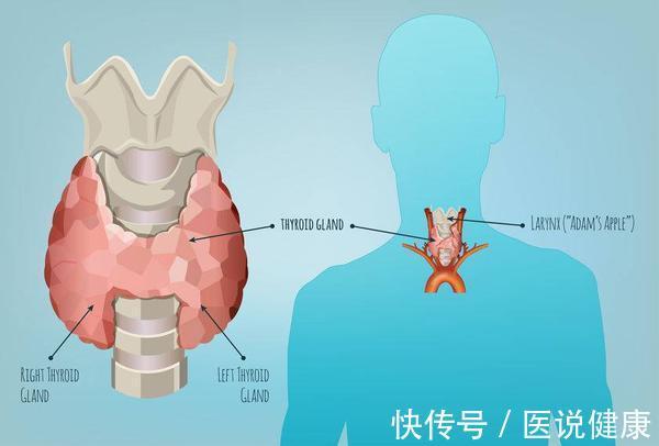 甲状腺结节怕癌变4种方法阻止它(甲状腺结节，做好这5点，或能避免发生恶变，需重视)