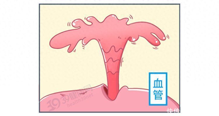 我国2亿多高血压患者，“祸根”找到了？少吃4类东西，血压稳稳地2023