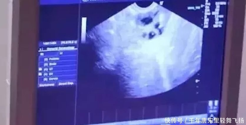 赴美|29岁女CEO赴美买精生5国混血儿：彪悍的人生，连生孩子都一人搞定