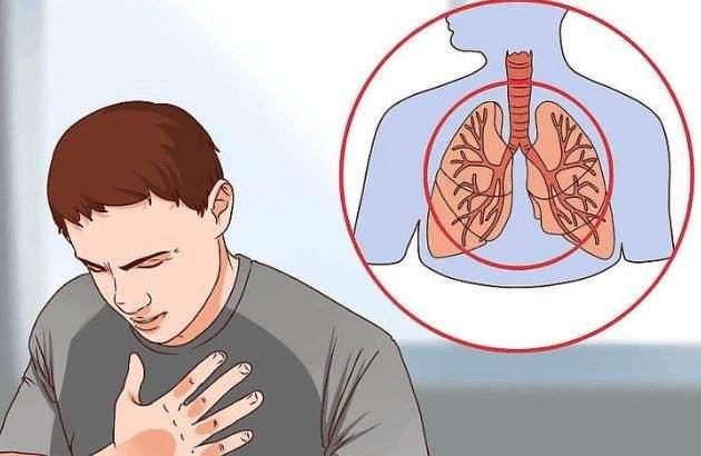 咳嗽|肺癌居癌症死亡第一,早期无症状,咳嗽别轻视
