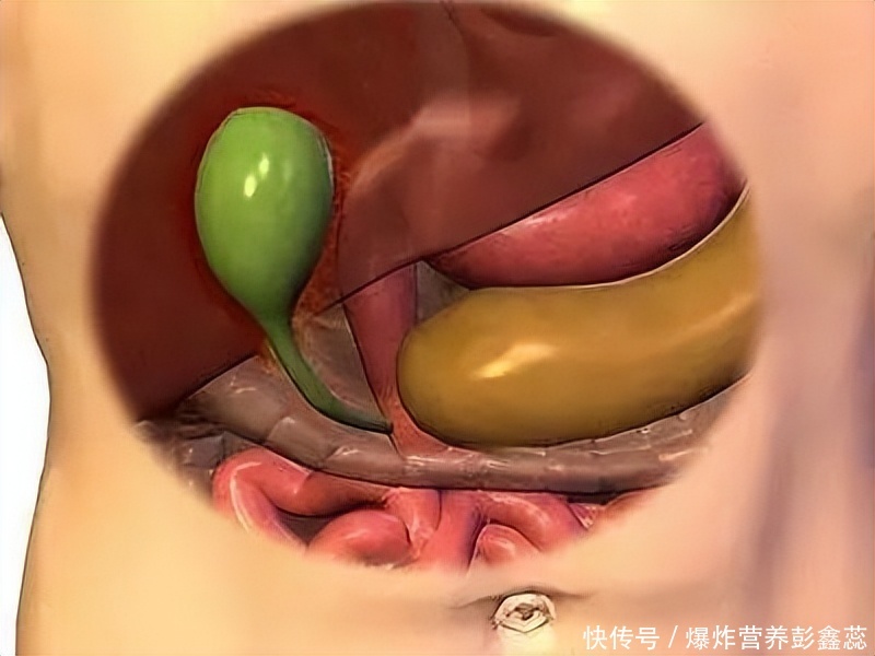 四种人胆囊息肉要警惕了(提示：有胆囊息肉的人，要记住这4件事，帮你让息肉越来越小)