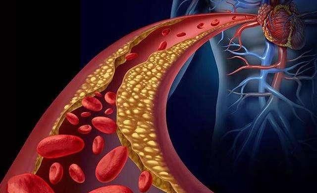 健康|用手摸一摸,就能知道血管健不健康?40岁开始做6件事,保养血管