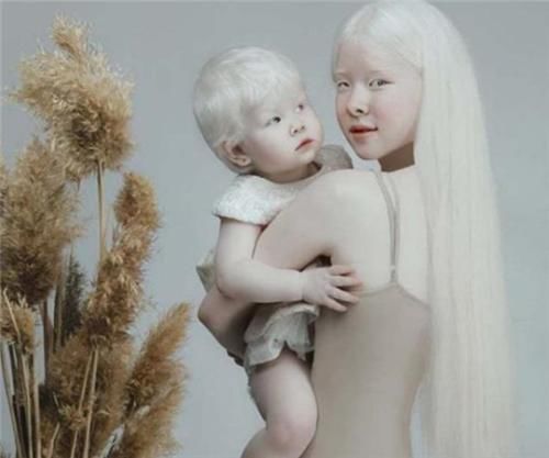  惊艳|罕见的“白雪公主”，却遭受了14年冷眼，拍完一组照片后惊艳全球