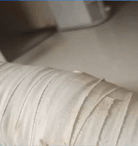 烧伤|搞笑GIF:面对烧伤的他,