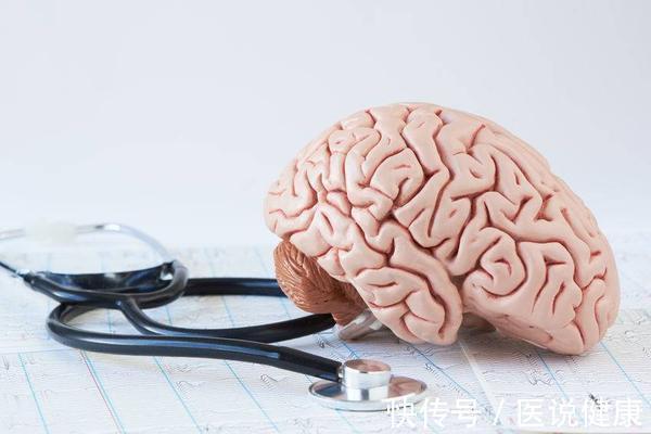 脑卒中发作前有什么症状(脑卒中在发生前，患者会出现这4个症状表现，要留心观察)
