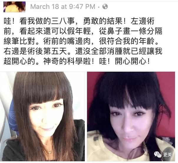  贵圈|贵圈首位直播整形女星、200w钻表随便摔，连范冰冰都模仿她！