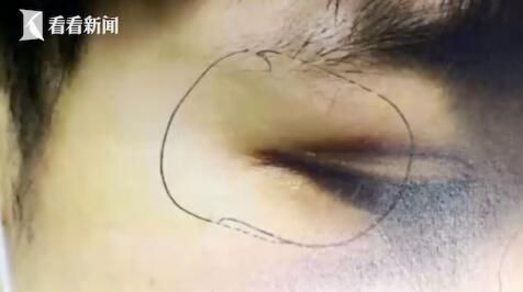 上海|车厢内乱挂雨伞引冲突 上海地铁一乘客鼻子被打断…