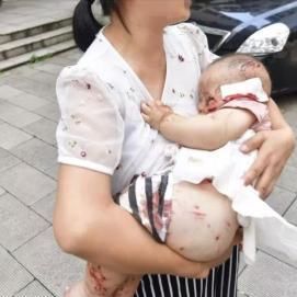  咬伤|狗患愈演愈烈，无辜儿童被狗咬伤咬死的事件经常发生