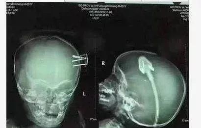  救救|“妈妈，救救我！” 也许你的孩子正面临着一样的危险！所有人都该看看