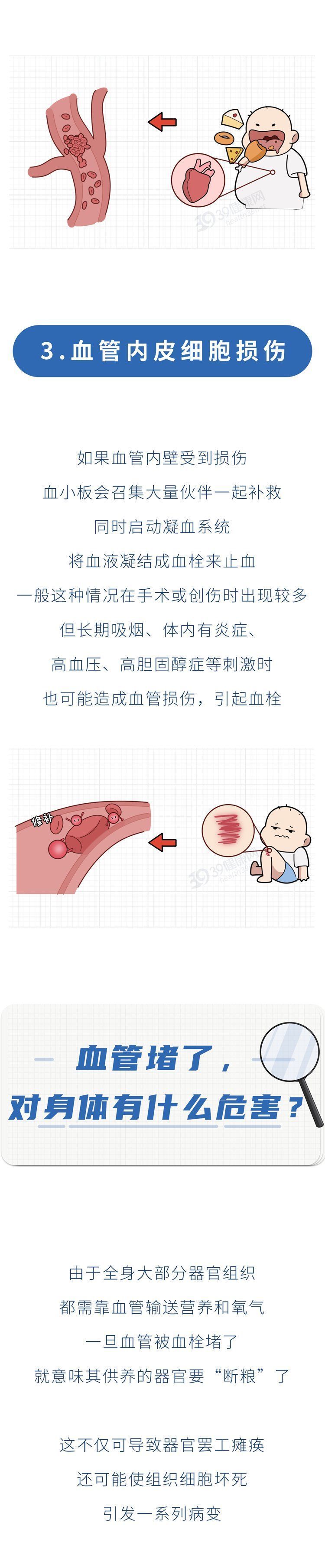 赶紧吃4大食物通血管灭脑梗(每天15000人死于脑梗，3种食物容易让血管变堵，尽量少吃)