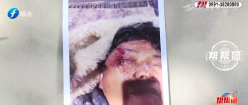  责任|工地塌方致工人受伤，责任谁担？承建方：未签订劳动合同