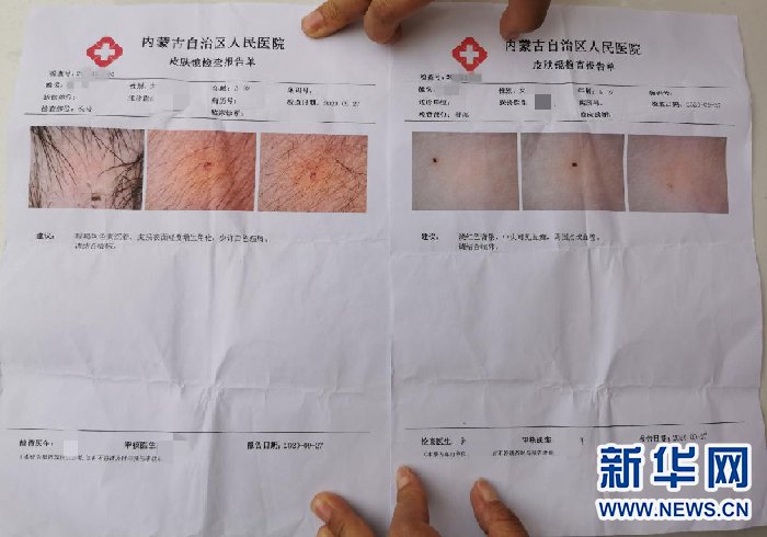 不明|呼和浩特幼儿园多名孩子身上现不明针眼 涉事3名教师被刑拘