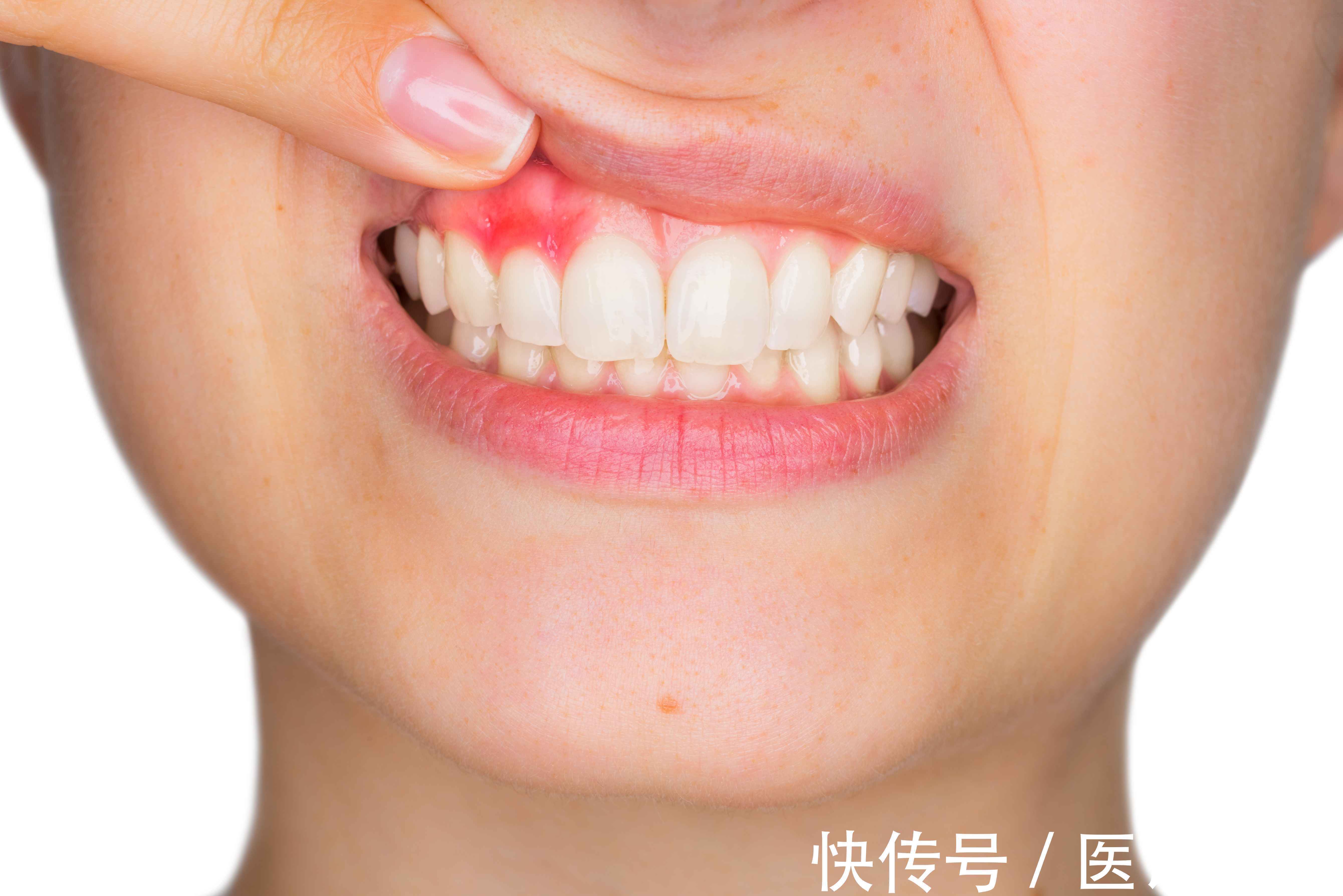 身体缺乏维生素c会有哪些表现(体内维生素C不足时，身体或有4个异常表现，要及时补充)
