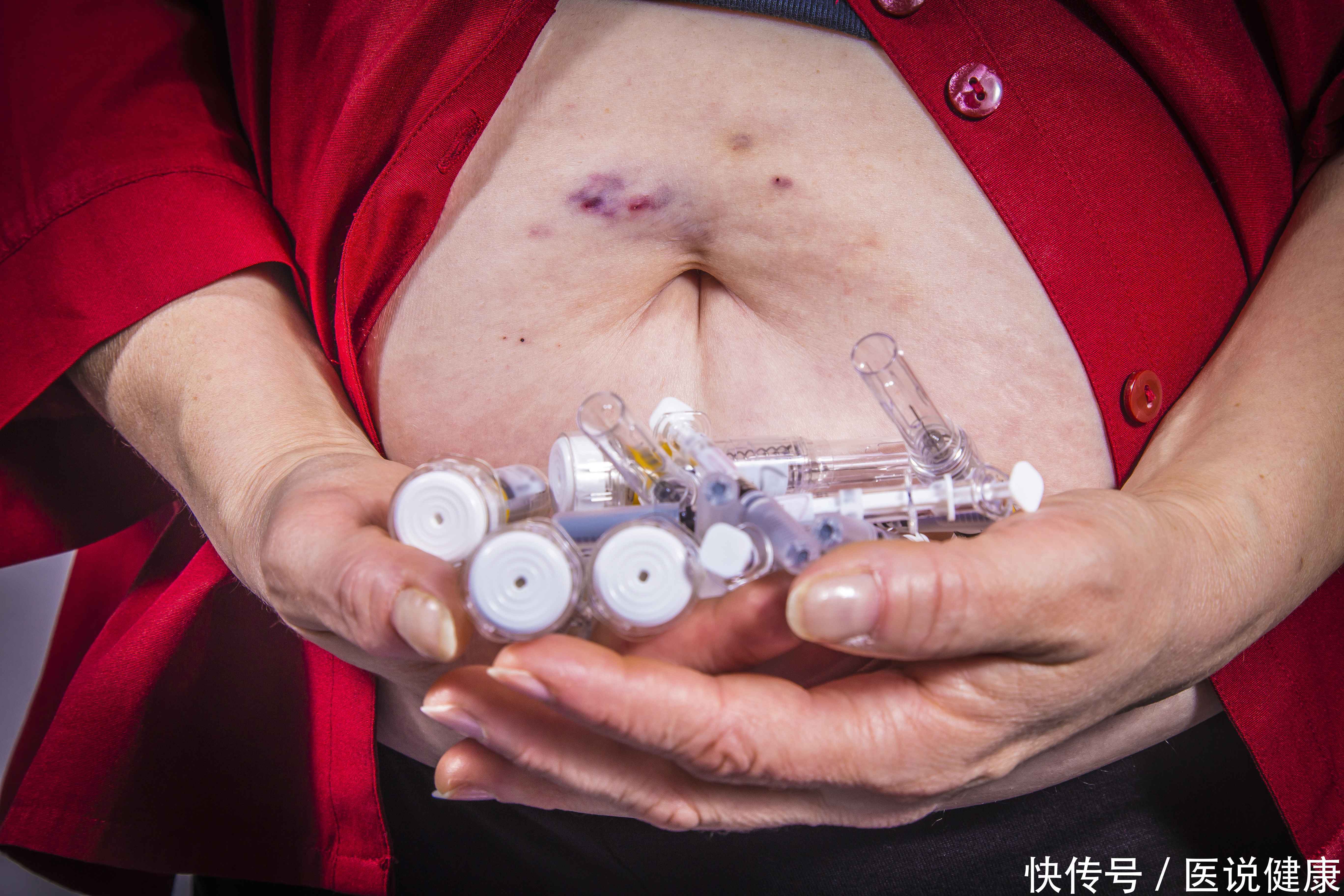 糖尿病人患上癌症的概率是多少(糖尿病患者，癌症的发病率高，尤其是这4个癌症，要重视)