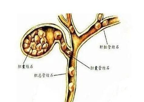 知识|夜宵吃了很多,为什么第二天早上反而更饿?涨知识了