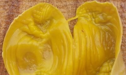 脾胃虚弱|“一两鸡内金一两金”，鸡最营养的部位，很多人当垃圾扔掉，浪费