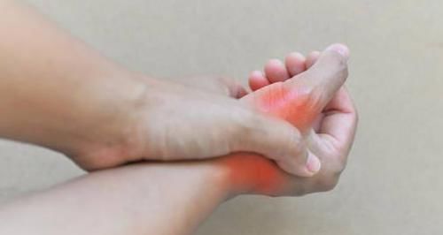  高尿酸|春节期间容易发作痛风？医生：做到这7点，让痛风高尿酸远离你