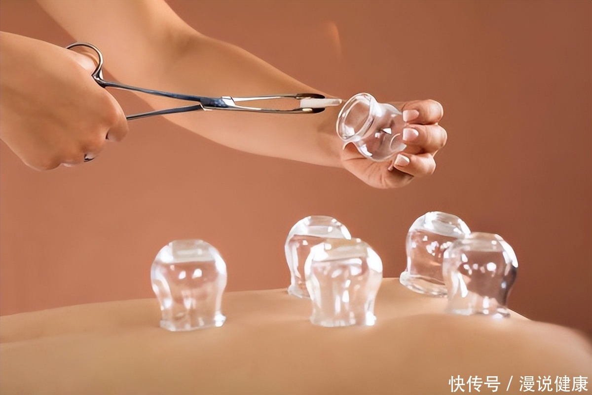 成都大运会拔罐(成都大运会“拔罐”预约火热？拔罐虽好，但对于5类人却不太适合)