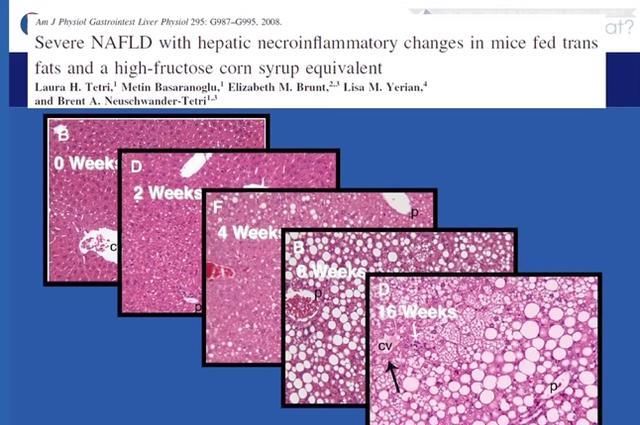 研究|清华最新研究：果糖“有毒”，扔掉果汁，少吃水果吧