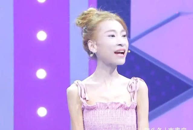 刘野|为了得到男友的爱,当年那个瘦至58斤的“骷髅女孩”,后来怎样?