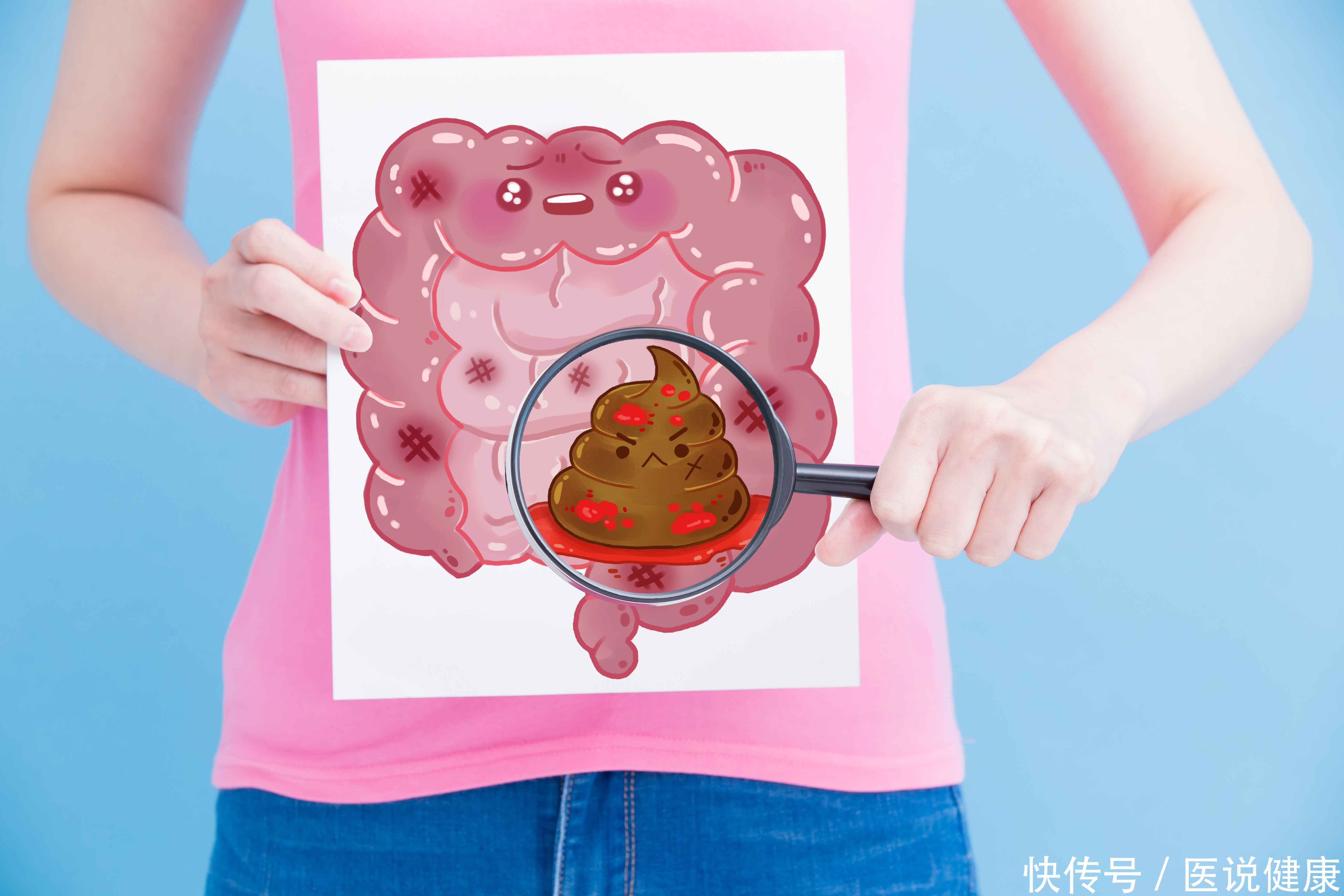 大便出血，分不清直肠癌和痔疮？医生：这个检查简单有效，别害羞2023