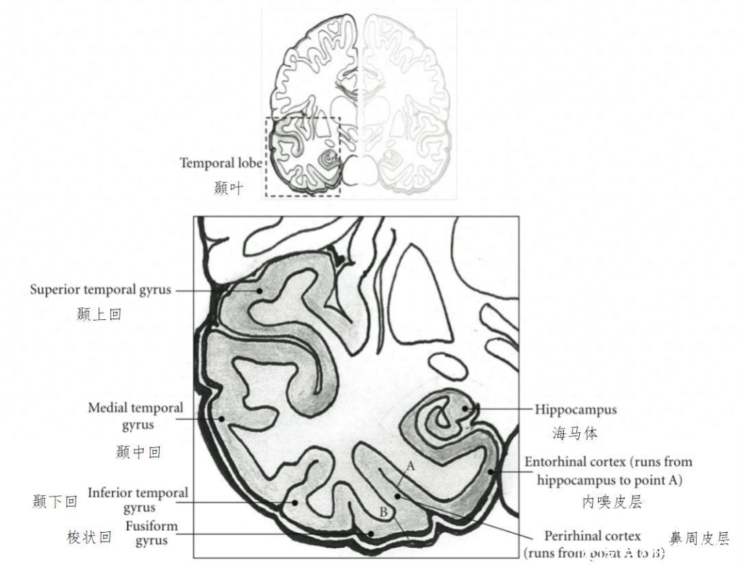 为什么脑子里会有似曾相识的感觉(为什么会有似曾相识的感觉？可能是你的大脑在纠正自己的错误！)