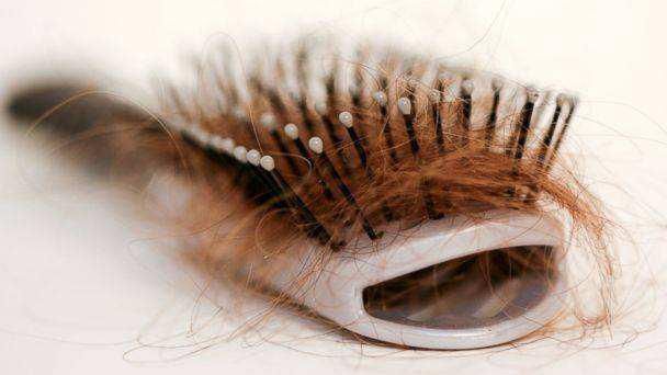 头发|除了头发经常清洗，还有梳子别忘了，满是油脂细菌不少