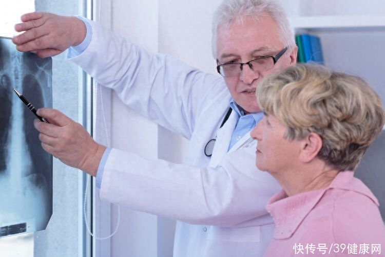 肺癌来临，腿部先知？提醒：双腿出现3个异常，建议尽早检查CT2023