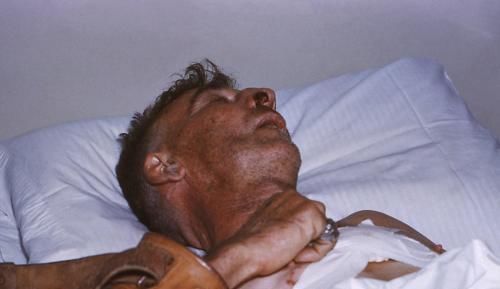 犬病毒|这种疾病是丧尸的原型,一旦发病死亡率近100%,该怎么预防?