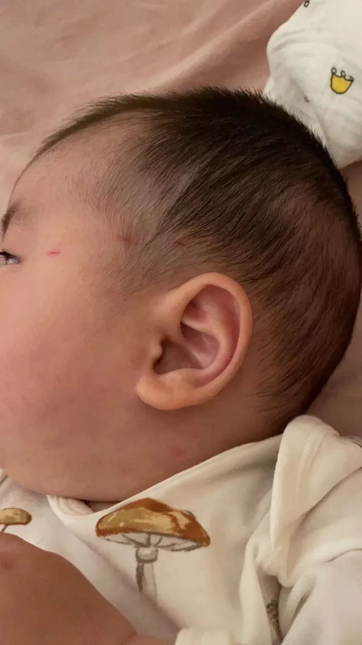 无人机失控，突然撞过来！杭城4个月大婴儿被割伤