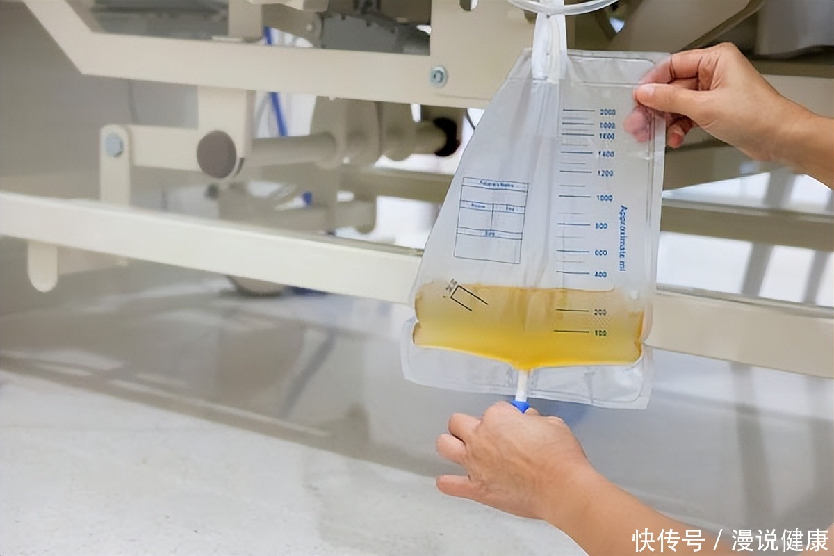 得了肾炎一定会出现尿蛋白吗(一旦查出尿蛋白，意味着患有肾炎？这3个原因，有的可能需要重视)