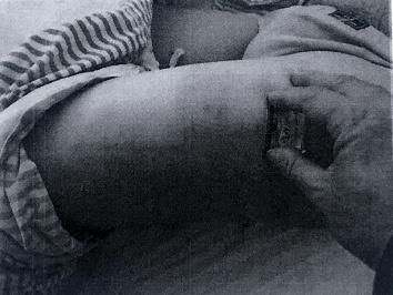 男子|男子持1米长棍殴打防疫人员 获刑八个月