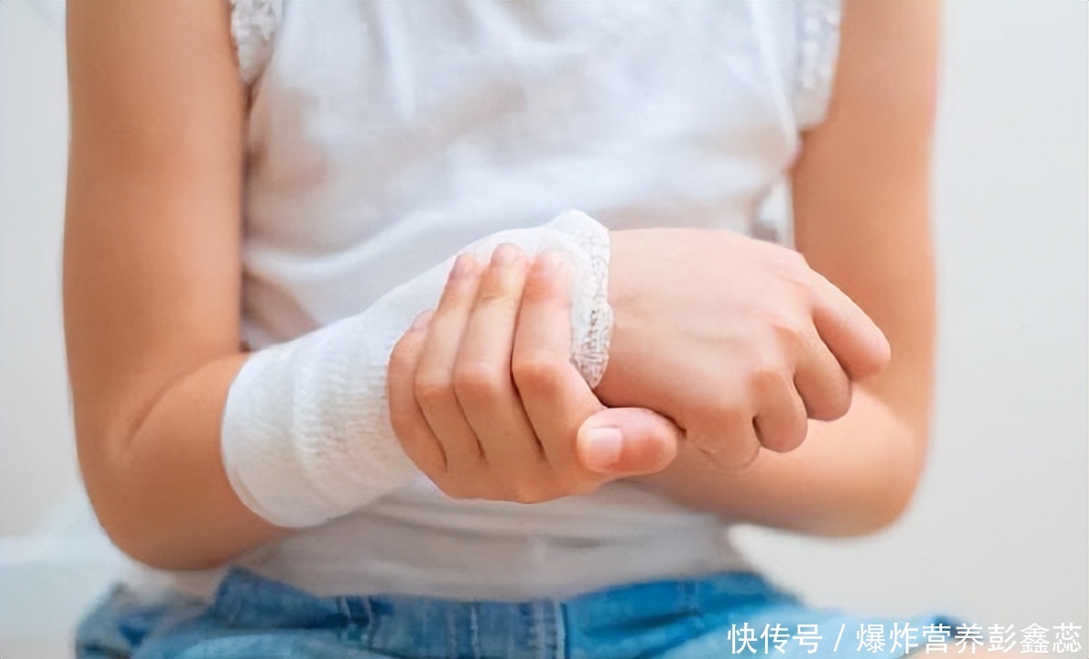 50岁以上的女性朋友们，有这4种表现当心骨质疏松，避免发生骨折2023