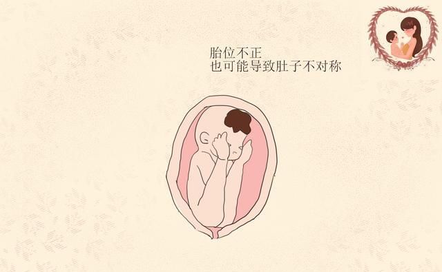  对称|为何孕肚两边不对称，看起来一边大一边小？准妈妈要知道原因