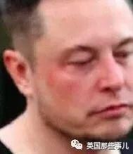 出庭|德普案证人出庭再爆猛料: Amber的伤可能是马斯克干的!这信息量略大啊…