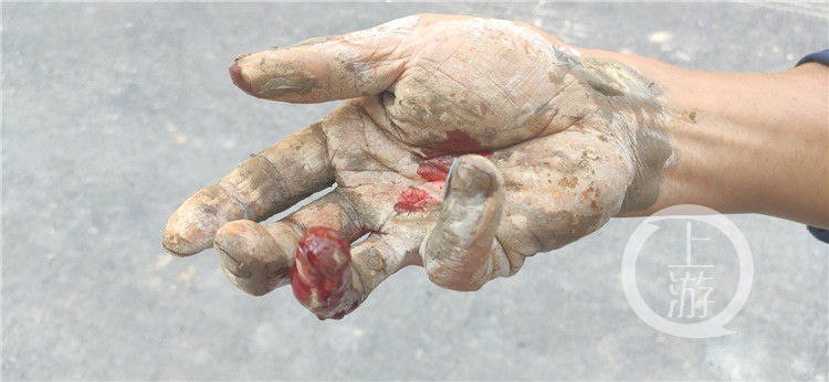 故事|红与黑!一张带血照片背后的故事