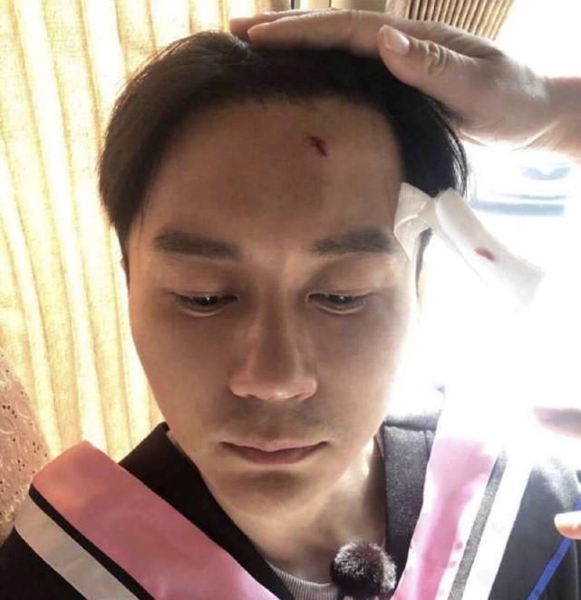  吸毒|杨颖手指骨折，杨洋吸毒气留后遗症，看似轻松的综艺也有风险