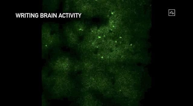  人脑|马斯克发布脑机接口：Neuralink无损植入猪脑，下一步植入人脑