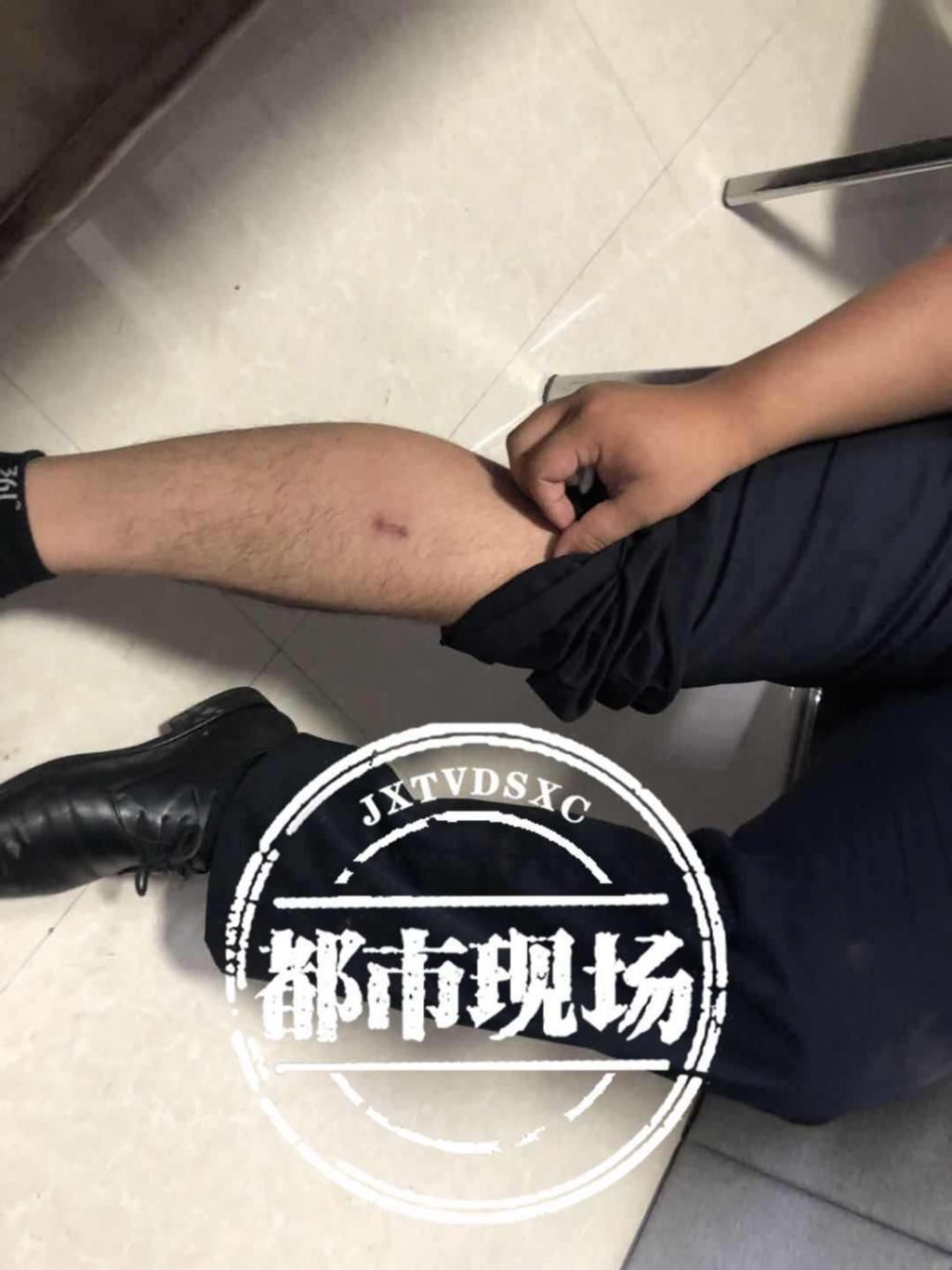  停车|拘！违法停车被处罚，女子不服竟撒泼咬伤2交警