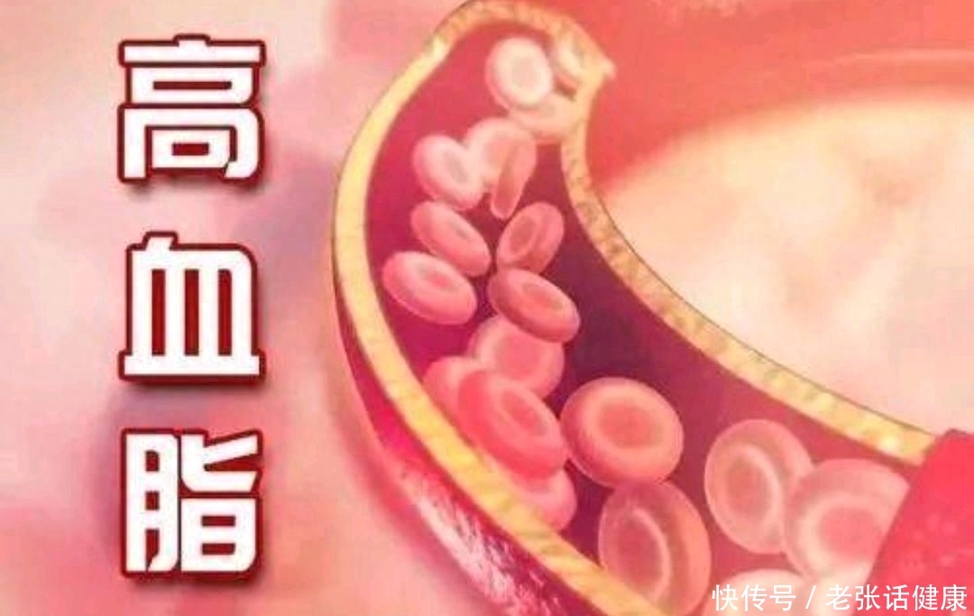 高血脂不可怕降血脂的两种方法(患了高血脂的人，建议牢记：晨起3不要，日常3坚持，有助于降血脂)
