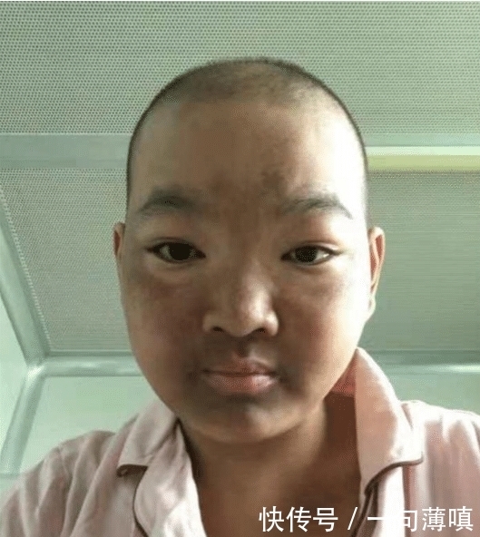 小波|“村花”嫁给穷小伙, 不幸患病“毁容”后对方的做法令人落泪