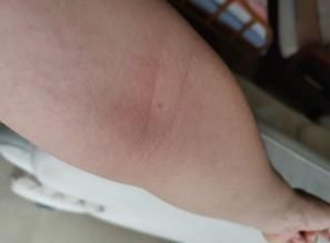 部位|怎样坚持拍打同一个部位一小时?