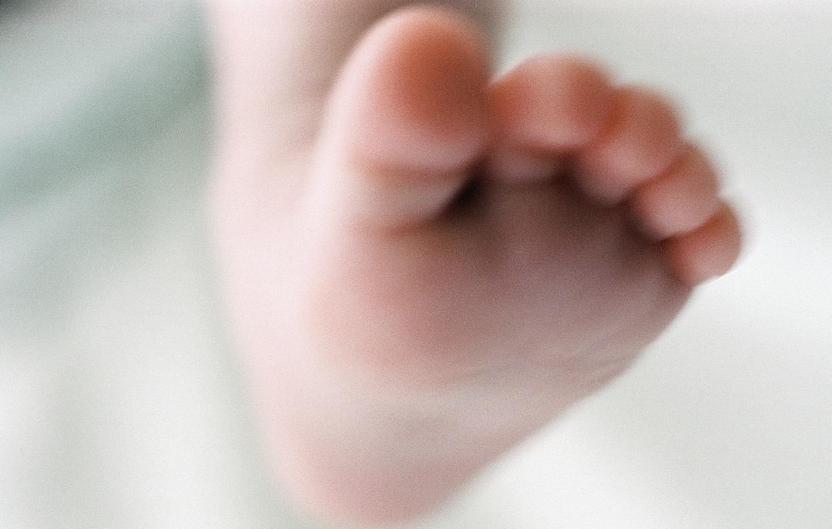  专家|皮肤过敏导致荨麻疹怎么办？皮肤科专家来支招