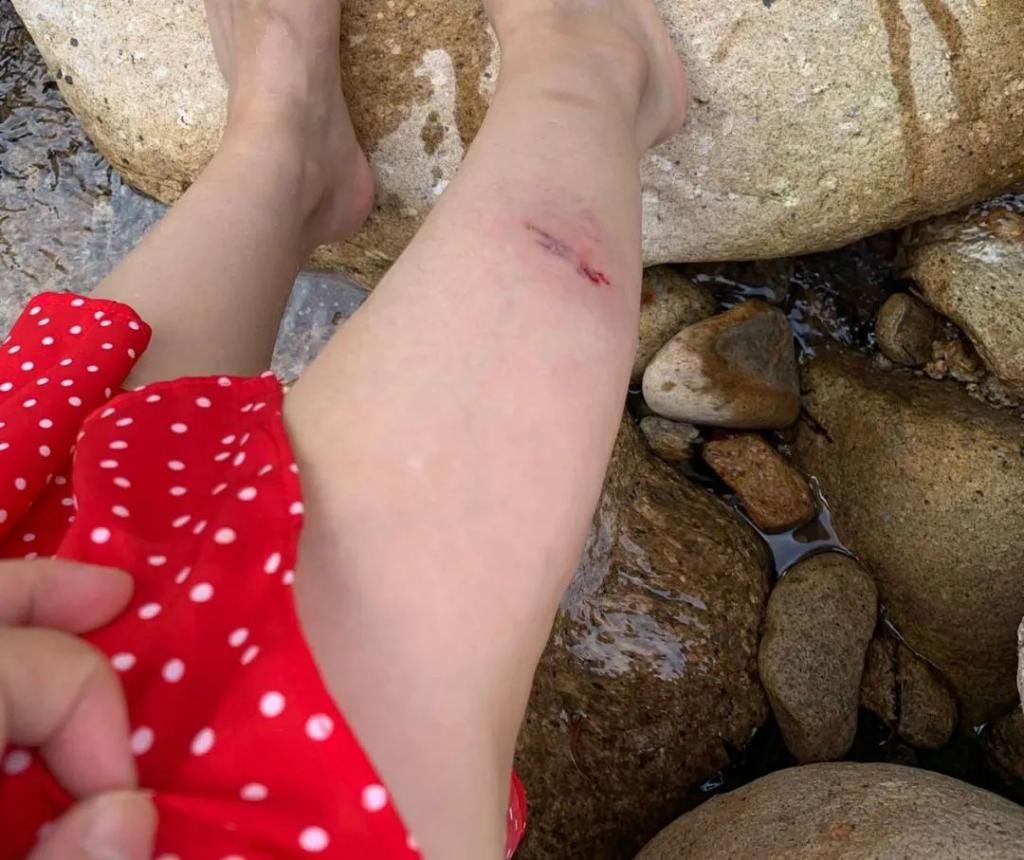  姑婆|危险！姑婆山里的“大师兄”进入狂暴模式，疯狂抢夺市民食物还把人伤了！