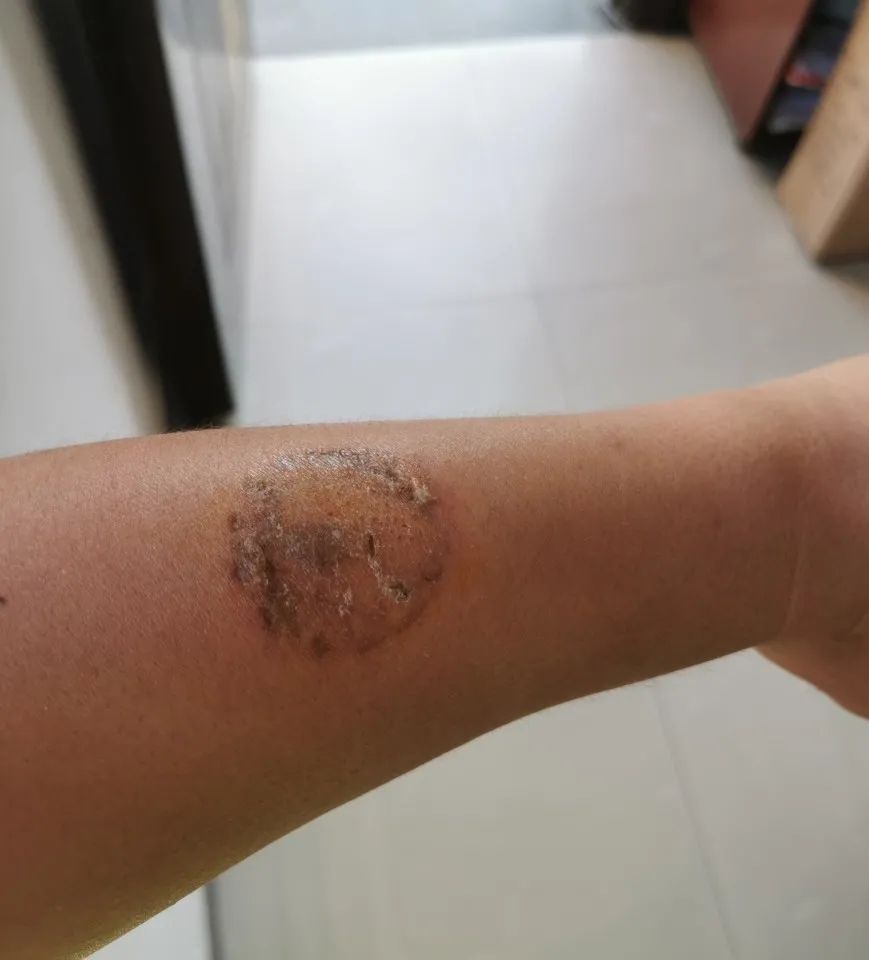 张兴猛|头盔与危险，20元与犯罪，你怎么选择！