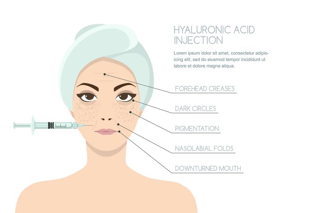 摇钱树|小S“摇钱树”计划稳了！母女同登封面似姐妹这是医美的力量？