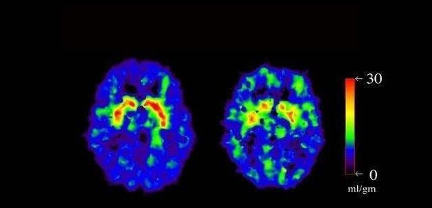 情绪|一个人吸冰毒成瘾后,精神上会发生哪些变化?