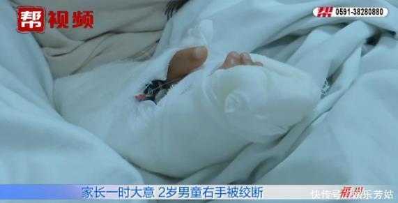 医生|家长来医院竟带着一只两岁男童的右手？在场所有人都惊呆了！