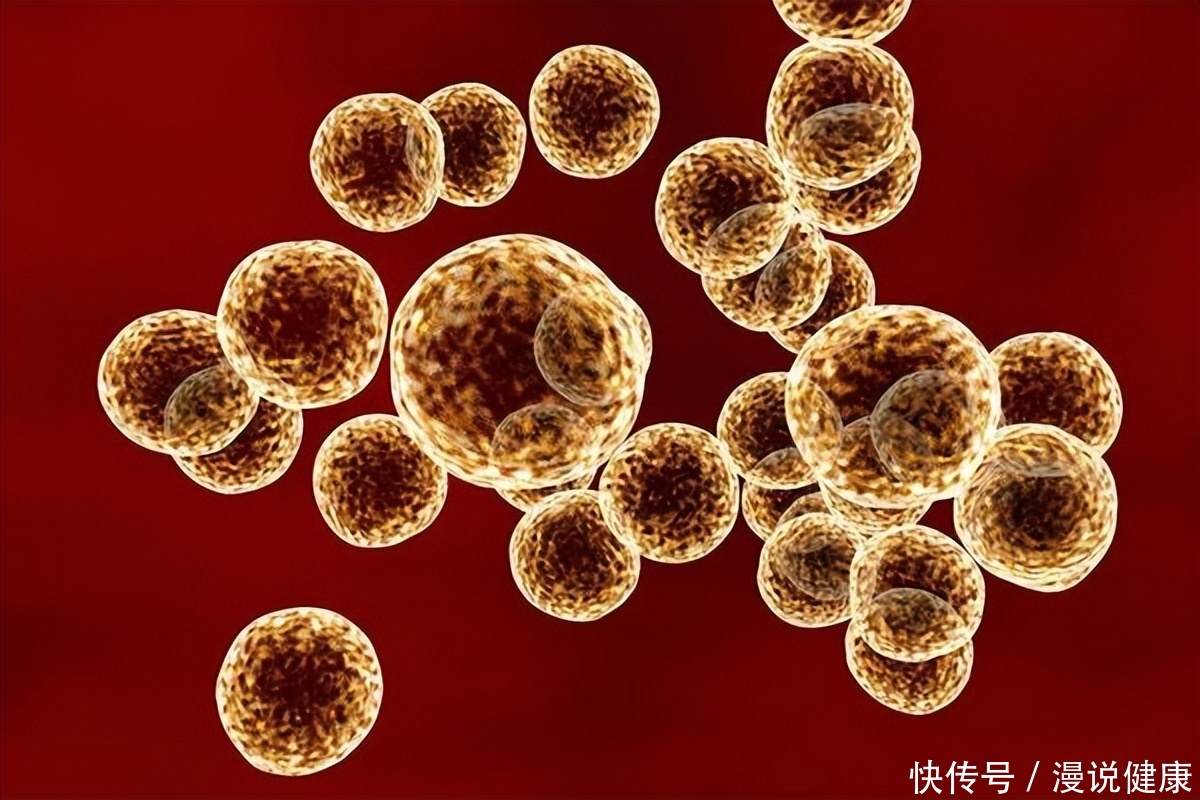 怎么判断是否感染猴痘(多地报告猴痘病例？提醒：出现这7种迹象，警惕是病毒的可能！)