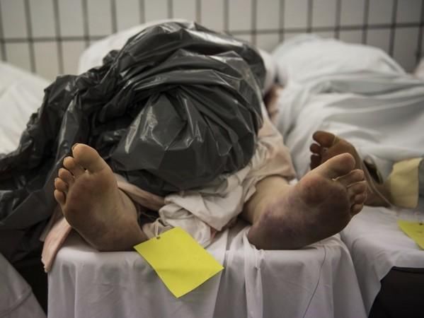 科诺诺娃|手术宣告死亡拉进停尸间 她躺一晚竟复活！伸手抓人吓坏女员工